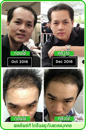 neo hair lotion