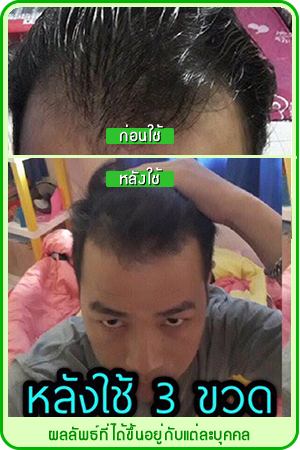 neo hair lotion